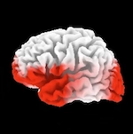 sLoreta Brain Image
